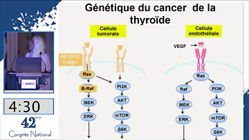 Quels sont les symptômes du cancer de la thyroïde ?