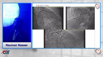 FFR Practical Tips & Tips by Nauman Naseer