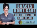 Braces Aftercare | Brushing | Maintenance | Diet | Pain Relief