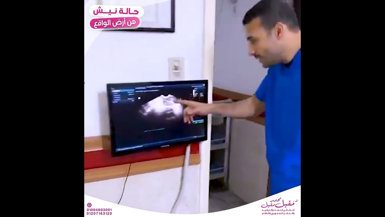 حالة نيش ( مشكلة جرح القيصرية) من أرض الواقع