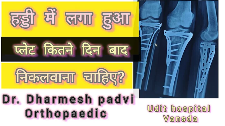 हड्डी में लगा हुआ प्लेट कितने दिन बाद निकलवाना चाहिए? When should bone plates be removed?