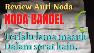 REVIEW ANTI NODA. Agar hasil optimal ikuti petunjuk dan penyebab noda.