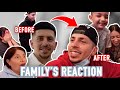 SHOWING OUR FAMILY MY BROTHER’S NEW SMILE!!