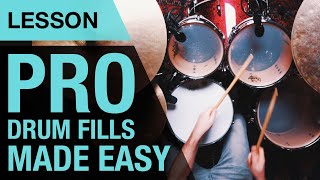 5 ways to improve your drum fills | Lesson