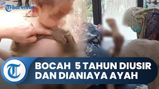 Bocah 5 Tahun Ditemukan Penuh Luka Di Depan Rumah Warga, Ternyata Diusir Dan Dianiaya Ayah Kandung