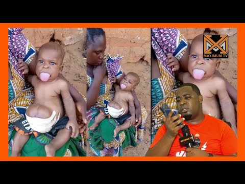 Video: Vilio Vya Tumbo Ndani Ya Mtoto Mdogo