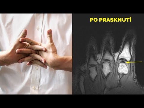 Video: Proč je praskání pupínků dobré?