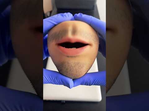 Will Mr Kiwi Return Mrkiwi Mrskiwi Fruitsurgery Foodsurgery 