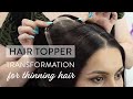Hair Topper Transformation for Thinning Hair