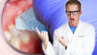 🧊 Dentist Explains TOOTH SENSITIVITY to COLD & Remedies! Why Front Teeth Hurt & Molar Toothache Pain