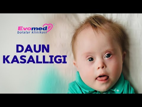 Kiritilgan sharlar porno bilan jinsiy olatni