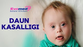 картинка: DAUN KASALLIGI XAQIDA | СИНДРОМ ДАУНА