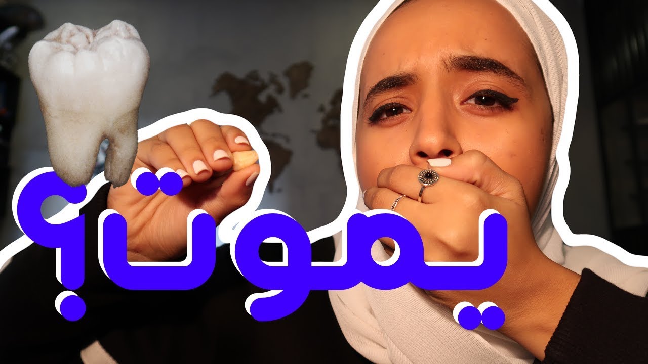خلعت ضرس العقل 🦷😱