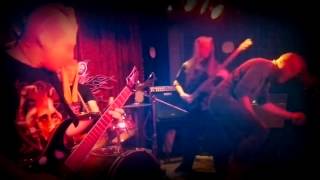 S.C.A.T. - Bowel Snap Ring (Tangential Section of Faeces)