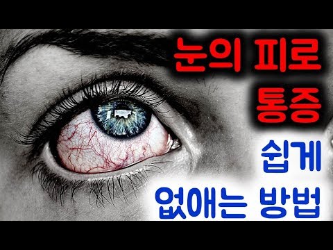 <strong>눈</strong> 아플때, 피로, 침침, 건조, 이물감 이유와 푸는법, 좋아지는법 (마사지, 경혈 지압, 손 발 눈반사구 마사지, 운동, 음식 등) [하늘건강나음터 창원]