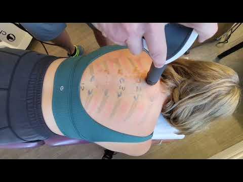 Thoracic Spine Treatment Pain and Treatment. Bra line pain? How do you  treat midback pain. 