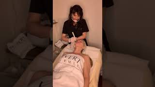 TRATTAMENTO VISO  CON MICRONEEDLING