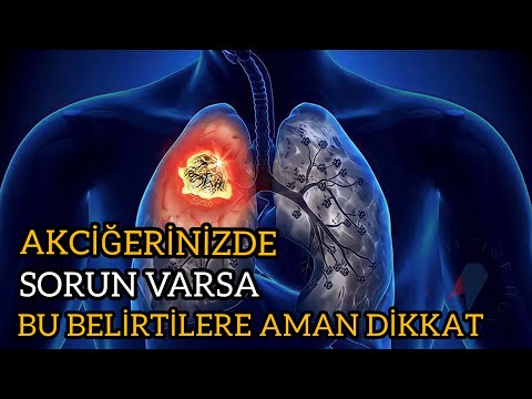 Akciğerinizde Sorun Varsa Bu Belirtilere Aman Dikkat! | Akciğer Kanseri Belirtileri