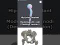 Modeling a Hip-joint Implant with nodi