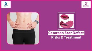 Struggling to Conceive After C-Section? It Could Be a Cesarean Scar Defect -Dr.Veenu|Doctors Circle