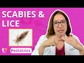 Scabies and Lice Quiz