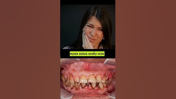 ẢNH HƯỞNG CỦA THUỐC LÁ ĐẾN SỨC KHỎE RĂNG MIỆNG | NHA KHOA NHÂN TÂM