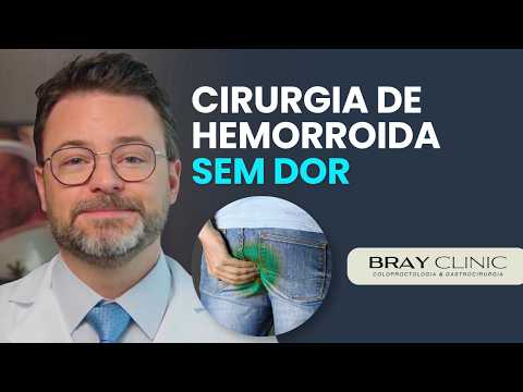 Vídeo: Cirurgia de Hemorroida Sem Dor Existe? Conheça 5 Técnicas Modernas