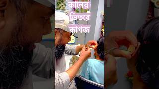 কানের ভেতরে কাগজ #নাক_কান_গলা #viralshort #doctor #shortsbreak # screenshot 4