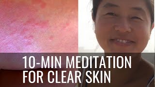 How to heal recurring skin issues - 10min guided meditation by Hungry Gopher 2,596 views 10 months ago 8 minutes, 42 seconds