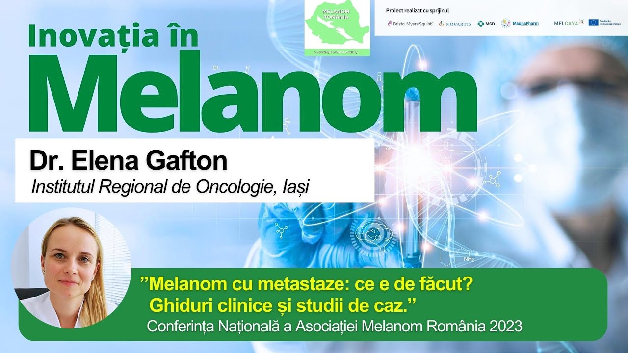 Dr. Elena Gafton ”Melanom cu metastaze ce e de făcut? Ghiduri clinice