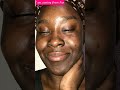 I TRANSFORMED MY SKIN FOREVER! FOREVER GRATEFUL FOR KNOWLEDGE! 2022 #SHORTS #SKIN #TRANSFORMATION