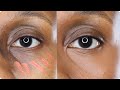 FULLY COVER DARK CIRCLES using Orange color corrector