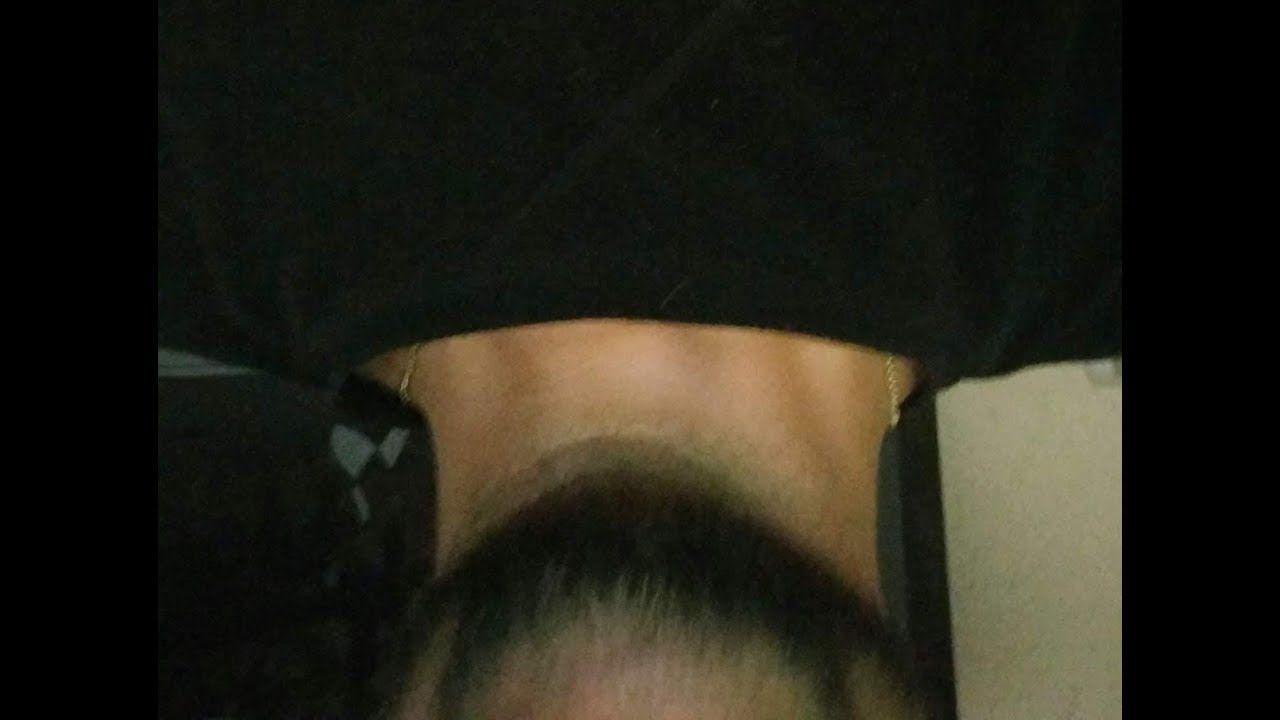 How to fix upside down camera problem. Xiaomi Mi5 Oreo 8.0.