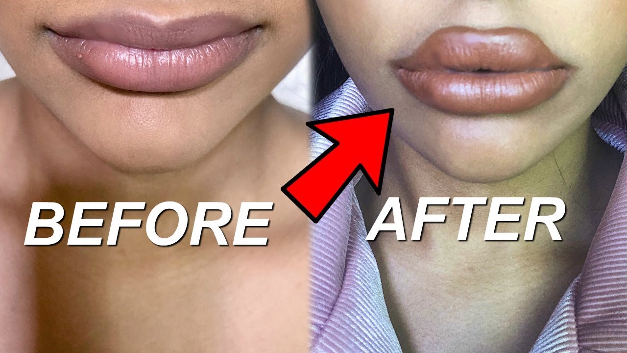 How I Make My Lips Look Big Lol Fake A Lip Job Youtube