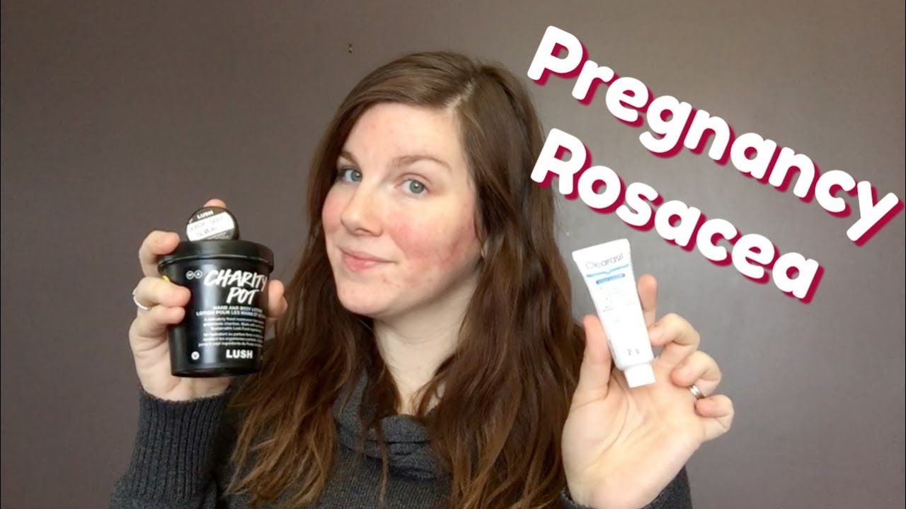 Pregnancy Skin Care Routine Rosacea Update! YouTube