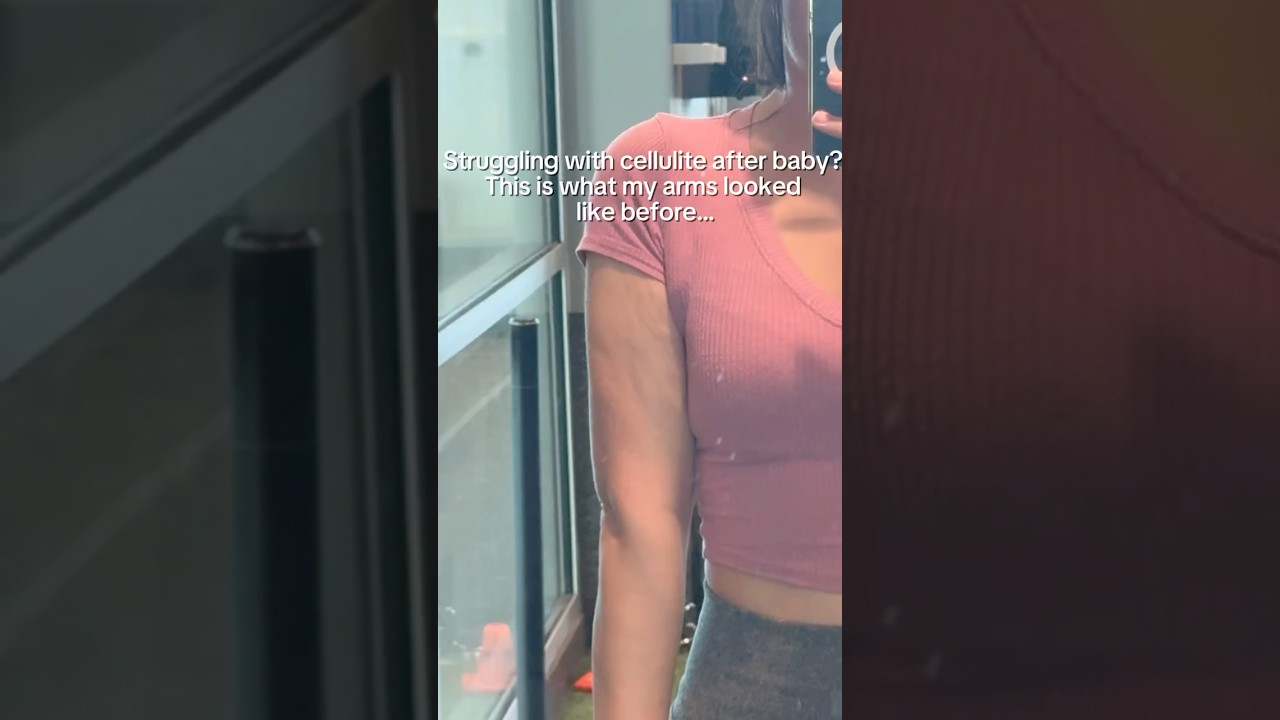 I’ve always struggled with cellulite, and this lotion really helped me.🙏🏻 ​⁠ 