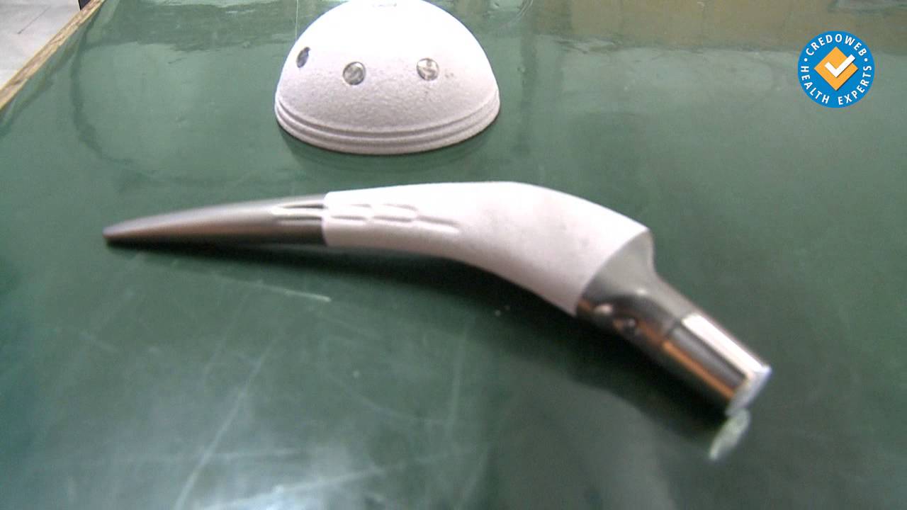 Модерни импланти компенсират голямата костна загуба