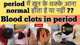 Period M Maas Ke Tukde Aana।पीरियड के बाद खून की कमी कैसे पूरी करें।