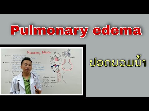 ປອດບວມນໍ້າ Pulmonary edema