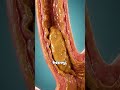 Eat Peanut Butter See What Happens to Your Body #healthtips #nutrition #shorts #fyp
