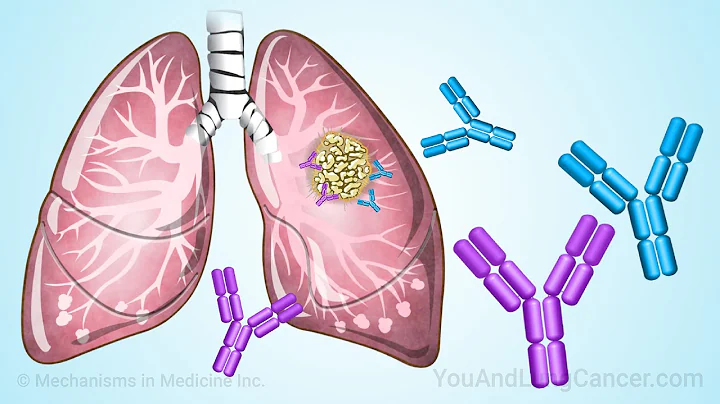 Immunotherapy Treatments for Small Cell Lung Cancer (SCLC) - updated 2025