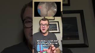 James K Polk and his infertility due to a bladder stone