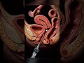 Why Doctors Use This Method 💉