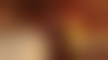 Perimplantitis y PRF block