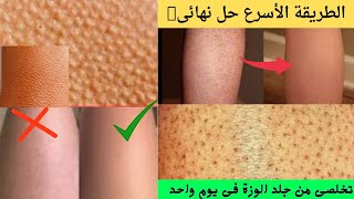 كيفية التخلص من جلد الوزة+علاج جلد الوزة بيوم واحد/تقشير الجسم وتفتيح البشرة #جلد_الوزة #جلد_الدجاجة