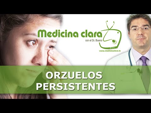 Video: ¿Por qué no desaparece mi orzuelo?