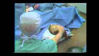 Download Lagu C-section birth with father in the delivery room news story from 1981 MP3 Download Lagu C-section birth with father in the delivery room news story from 1981 MP3