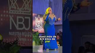 🟢👏 Sheyla reveló que donó su piel para salvar vidas. Wealth