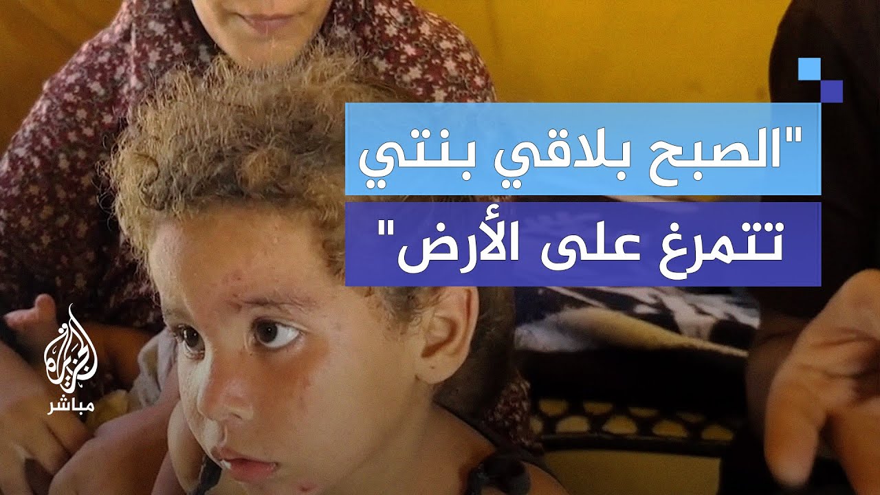 انتشار الحشرات وانعدام مواد النظافة يصيب أطفال أسرة نازحة في النصيرات بالطفح الجلدي