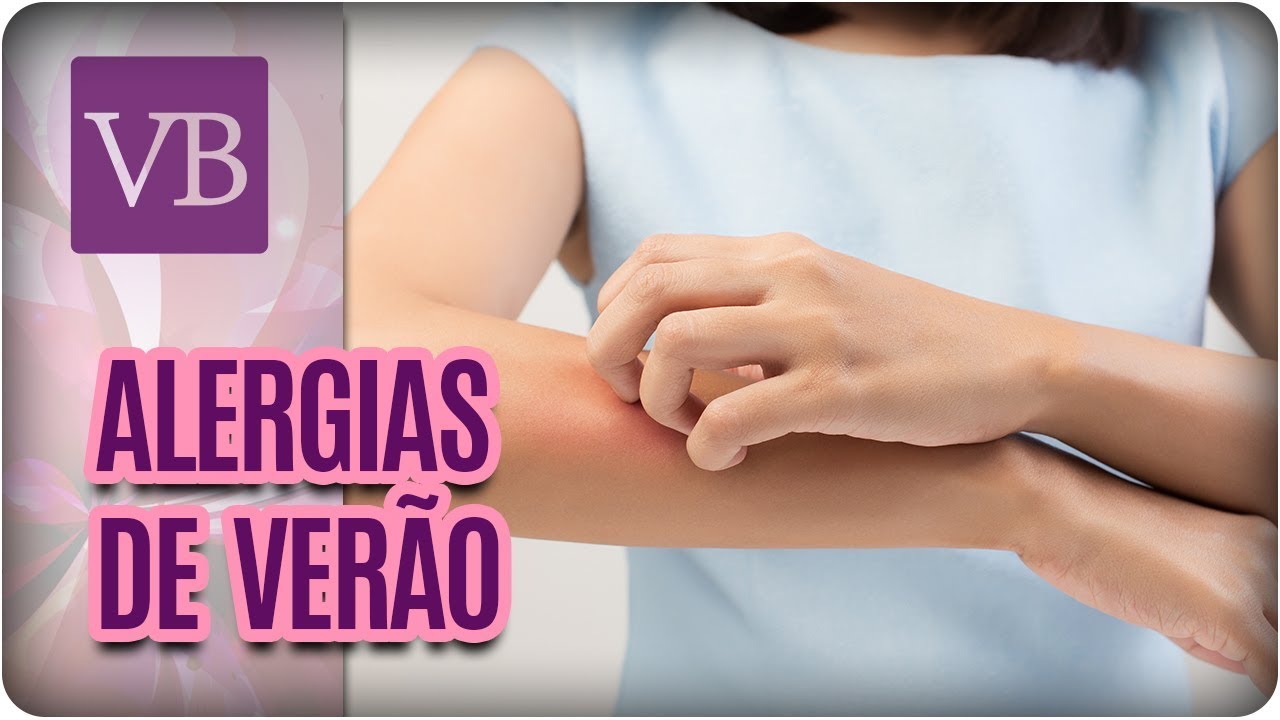 Alergias de Verão - Você Bonita (23/01/18) alergias en niños ronchas